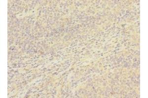 Immunohistochemistry of paraffin-embedded human tonsil tissue using ABIN7171407 at dilution of 1:100 (CD8B anticorps  (AA 22-170))