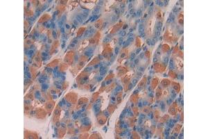 Used in DAB staining on fromalin fixed paraffin- embedded stomach tissue (ABCA2 anticorps  (AA 2201-2434))
