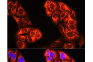Immunofluorescence analysis of U-2 OS cells using MTHFD1 Polyclonal Antibody at dilution of 1:100 (40x lens).