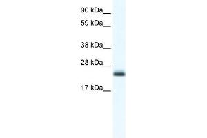 WB Suggested Anti-Tppp Antibody Titration:  1. (Tppp anticorps  (C-Term))