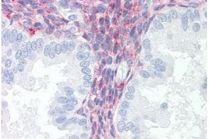 Human Uterus (formalin-fixed, paraffin-embedded) stained with LRP1 antibody ABIN351532 at 10 ug/ml followed by biotinylated anti-mouse IgG secondary antibody ABIN481714, alkaline phosphatase-streptavidin and chromogen. (LRP1 anticorps)
