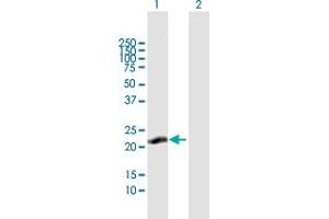 Western Blot analysis of C13orf1 expression in transfected 293T cell line by C13orf1 MaxPab polyclonal antibody. (CLLD6 anticorps  (AA 1-196))