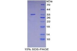Src Homology 2 Domain Containing Adapter Protein B protein