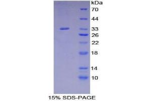 SDS-PAGE analysis of Human SHB Protein. (Src Homology 2 Domain Containing Adapter Protein B Protéine)
