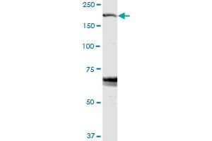 ZFYVE9 MaxPab rabbit polyclonal antibody. (ZFYVE9 anticorps  (AA 1-762))