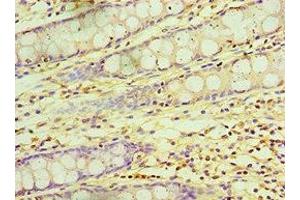 Immunohistochemistry of paraffin-embedded human colon tissue using ABIN7145839 at dilution of 1:100 (KCTD15 anticorps  (AA 1-234))