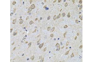Immunohistochemistry of paraffin-embedded Mouse brain using NFU1 Polyclonal Antibody at dilution of 1:100 (40x lens). (NFU1 anticorps)