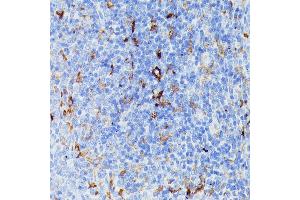 Immunohistochemistry of paraffin-embedded rat spleen using MMP25 antibody (ABIN7268422) at dilution of 1:100 (40x lens). (MMP25 anticorps  (AA 350-540))