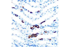 Immunohistochemistry of paraffin-embedded mouse kidney using PIWIL1 Rabbit mAb (ABIN7269381) at dilution of 1:100 (40x lens). (PIWIL1 anticorps)