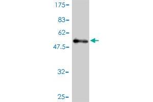Western Blot detection against Immunogen (51. (USP15 anticorps  (AA 1-235))