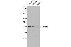 WB Image TRIM27 antibody detects TRIM27 protein by western blot analysis. (TRIM27 anticorps)