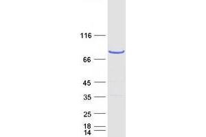 Validation with Western Blot