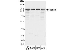 Western Blotting (WB) image for anti-hSET1 (AA 1200-1250) antibody (ABIN7449888) (hSET1 (AA 1200-1250) anticorps)