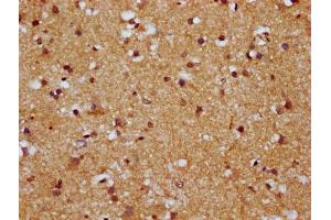 IHC image of ABIN7164031 diluted at 1:500 and staining in paraffin-embedded human brain tissue performed on a Leica BondTM system. (HCN1 anticorps  (AA 784-887))