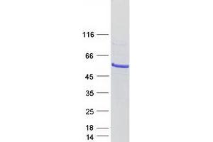Validation with Western Blot