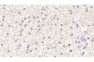 Detection of GSTM1 in Human Liver Tissue using Polyclonal Antibody to Glutathione S Transferase Mu 1 (GSTM1)