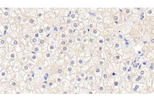 Detection of GSTM1 in Human Liver Tissue using Polyclonal Antibody to Glutathione S Transferase Mu 1 (GSTM1) (GSTM1 anticorps  (AA 1-218))