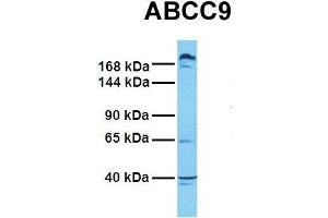 Host:  Rabbit  Target Name:  ABCC9  Sample Tissue:  Human PANC1  Antibody Dilution:  1. (ABCC9 anticorps  (Middle Region))