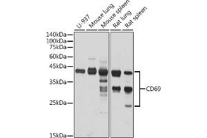 Western blot analysis of extracts of various cell lines, using CD69 antibody (ABIN3022774, ABIN3022775, ABIN3022776 and ABIN6219223) at 1:1000 dilution. (CD69 anticorps  (AA 62-199))