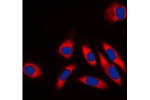 Immunofluorescent analysis of HSP60 staining in NIH3T3 cells. (HSPD1 anticorps  (C-Term))