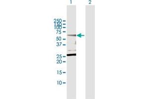 Western Blot analysis of CPNE1 expression in transfected 293T cell line by CPNE1 MaxPab polyclonal antibody. (CPNE1 anticorps  (AA 1-537))
