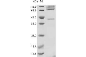 (Tris-Glycine gel) Discontinuous SDS-PAGE (reduced) with 5 % enrichment gel and 15 % separation gel.