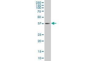 TFDP3 monoclonal antibody (M02), clone 3F11 Western Blot analysis of TFDP3 expression in IMR-32 . (TFDP3 anticorps  (AA 1-100))
