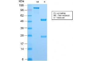 SDS-PAGE Analysis Purified Topo I Rabbit Recombinant Monoclonal Antibody (TOP1MT/2883R).