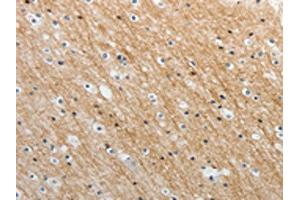The image on the left is immunohistochemistry of paraffin-embedded Human brain tissue using ABIN7189659(ADAMTS19 Antibody) at dilution 1/25, on the right is treated with synthetic peptide. (ADAMTS19 anticorps)