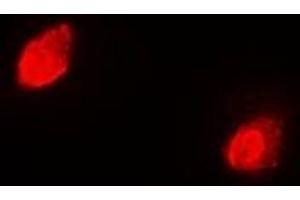 Immunofluorescent analysis of RACK1 staining in Hela cells.