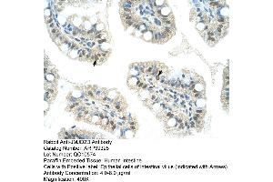 Human Intestine (JMJD2D anticorps  (C-Term))