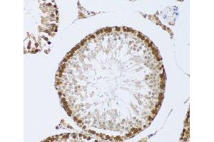 Immunohistochemistry of paraffin-embedded Mouse testis using CIRBP Polyclonal Antibody at dilution of 1:100 (20x lens). (CIRBP anticorps)