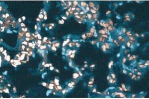 Immunohistochemical staining of a rabbit lung section. (SMARCA2 anticorps  (AA 1400-1586))