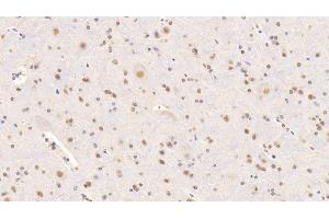 Detection of NCL in Mouse Spinal cord Tissue using Polyclonal Antibody to Nucleolin (NCL)
