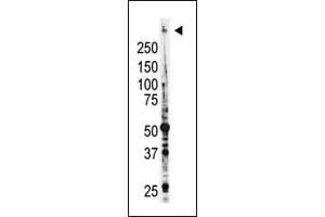 Image no. 2 for anti-Myeloid/lymphoid Or Mixed-Lineage Leukemia (MLL) (C-Term) antibody (ABIN356674) (MLL/KMT2A anticorps  (C-Term))