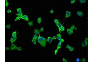 Immunofluorescence staining of SH-SY5Y cells with ABIN7169916 at 1:66, counter-stained with DAPI.
