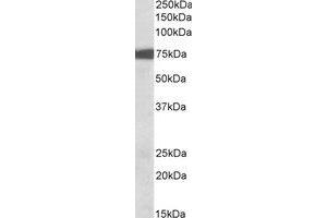 Western Blotting (WB) image for anti-Ribosomal Protein S6 Kinase, 90kDa, Polypeptide 2 (RPS6KA2) (C-Term) antibody (ABIN2464829) (RPS6KA2 anticorps  (C-Term))
