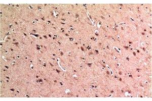 Immunohistochemistry of paraffin-embedded Human brain tissue using BECN1 Monoclonal Antibody at dilution of 1:200. (Beclin 1 anticorps)