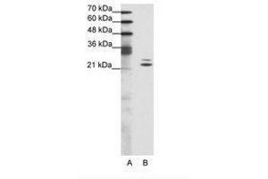 Image no. 1 for anti-BUD31 Homolog (BUD31) (AA 71-120) antibody (ABIN202030) (BUD31 anticorps  (AA 71-120))