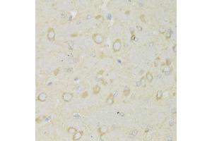 Immunohistochemistry of paraffin-embedded rat brain using TRAP1 Antibody (ABIN1875197) at dilution of 1:100 (40x lens). (TRAP1 anticorps)