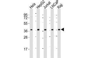 All lanes : Anti-DFFB Antibody (N-term) at 1:2000 dilution Lane 1: Hela whole cell lysates Lane 2: HepG2 whole cell lysates Lane 3: Jurkat whole cell lysates Lane 4: LNCaP whole cell lysates Lane 5: Raji whole cell lysates Lysates/proteins at 20 μg per lane. (DFFB anticorps  (N-Term))