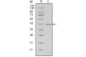 Western blot analysis using LAMB1 mouse mAb against truncated LAMB1-His recombinant protein (1). (Laminin beta 1 anticorps  (AA 31-270))