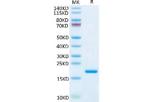 IL-20 Protein (AA 25-176) (His tag)