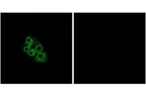 Immunofluorescence analysis of A549 cells, using LSHR Antibody. (LHCGR anticorps  (AA 621-670))