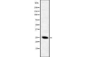 Western blot analysis of Phospho-CD28 (Tyr218) using Jurkat whole cell lysates (CD28 anticorps  (pTyr218))