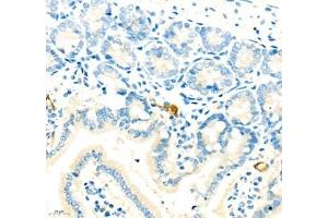 Immunohistochemistry of paraffin embedded mouse small intestine using MADCAM1 (ABIN7074695) at dilution of 1:1700 (400x lens) (MADCAM1 anticorps)
