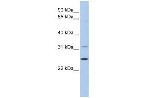 WB Suggested Anti-DHRS1 Antibody Titration: 0. (DHRS1 anticorps  (N-Term))