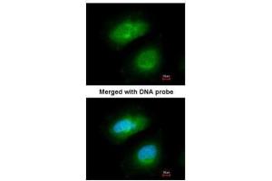 ICC/IF Image Immunofluorescence analysis of paraformaldehyde-fixed HeLa, using PRAK, antibody at 1:200 dilution.