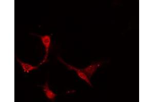ABIN6274159 staining A549 cells by IF/ICC. (TACSTD2 anticorps  (Internal Region))