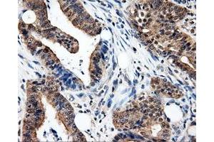Immunohistochemistry (IHC) image for anti-Proteasome (Prosome, Macropain) 26S Subunit, ATPase, 3 (PSMC3) antibody (ABIN1501331) (PSMC3 anticorps)